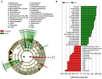 Combined Signature of the Fecal Microbiome and Metabolome in Patients with Gout
